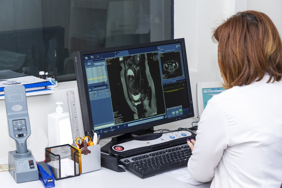 Doctor using computer to analyzing brain MRI in radiology room of the hospital